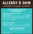 Earth Animal Natural Remedies Allergy & Skin Liquid Homeopathic Allergy Supplement for Dogs & Cats